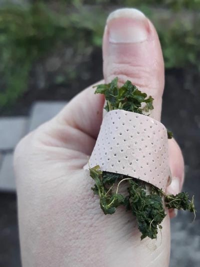 Herbal poultice on thumb injury with bandaid.